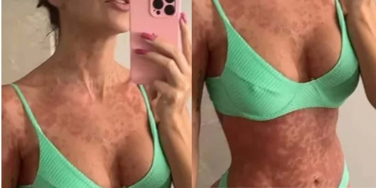 Ex-bbb, Leticia Santiago, desmorona ao falar sobre doença (Reprodução)