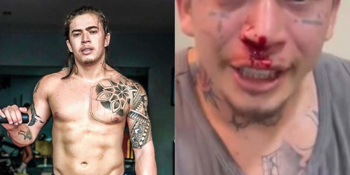 Whindersson Nunes surge todo ensanguentado após sair no soco com rapaz e detona: "Mexi com o cara errado" - Reprodução Instagram