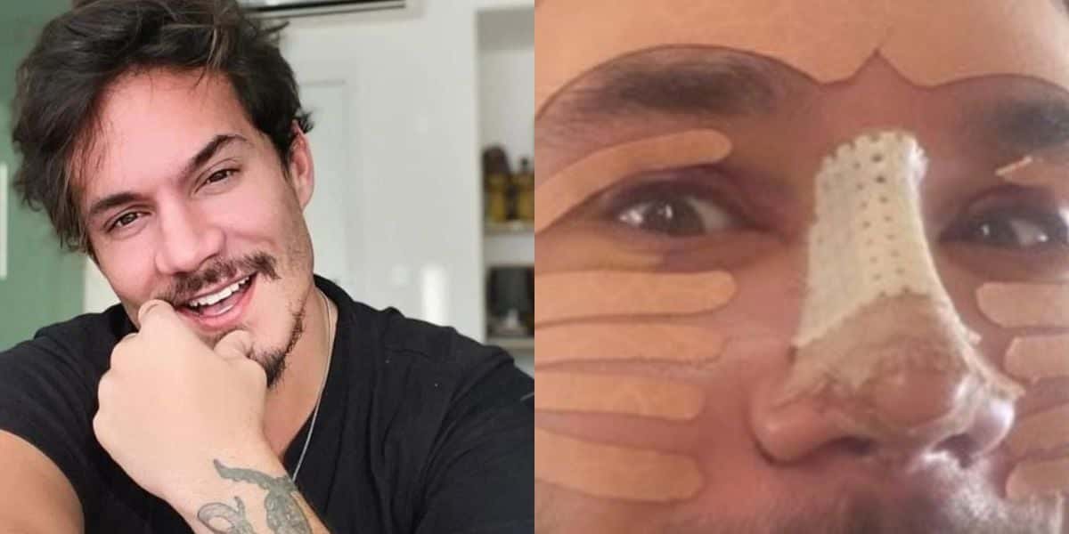 Eliezer, namorado de Viih Tube, surge com rosto cheio de curativos, sem dente e aparência assusta - Reprodução