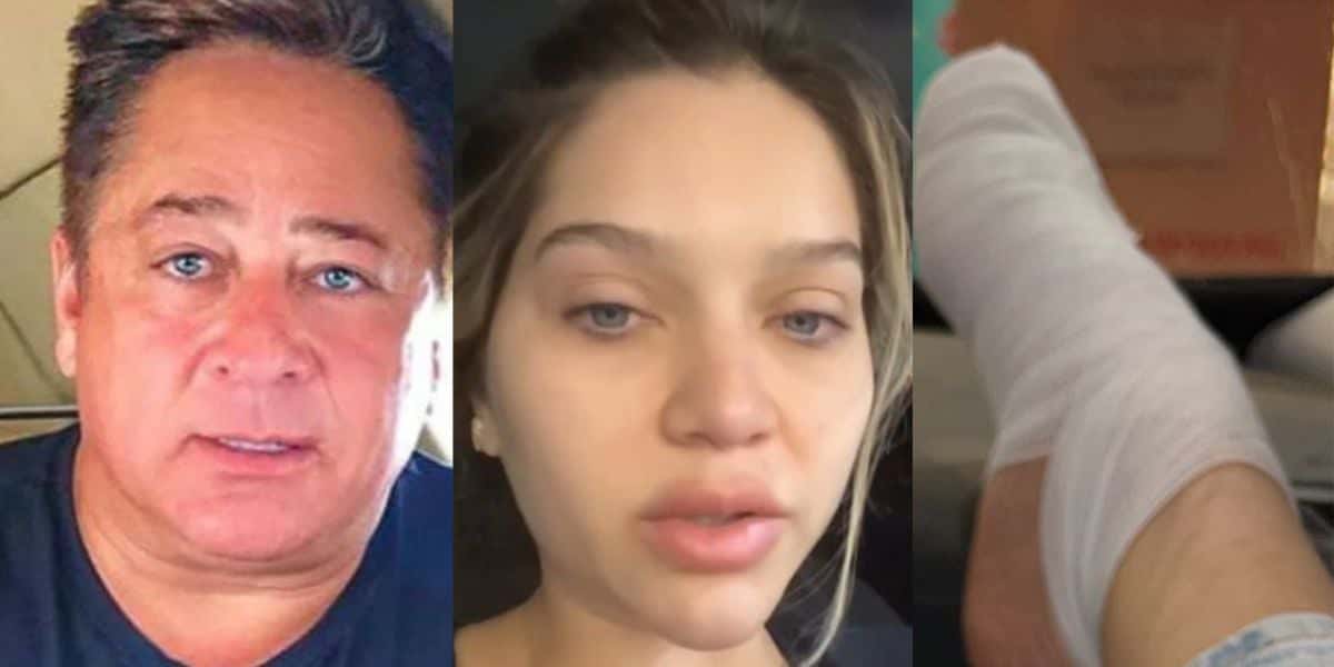 Filha de Leandro, sobrinha de Leonardo, sofre acidente e surge ensanguentada com fratura: 'Desesperada" - Reprodução