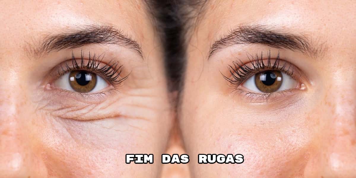 Fim das rugas com essas receitinhas milagrosas (Foto: Divulgação)