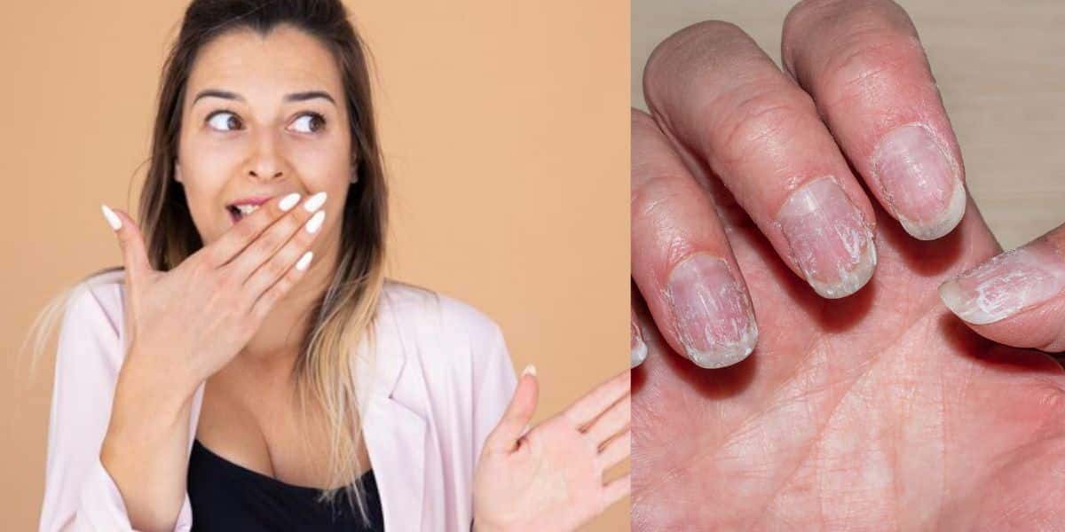 Mulher e unhas quebradiças (Fotos: Reproduções / Canva)