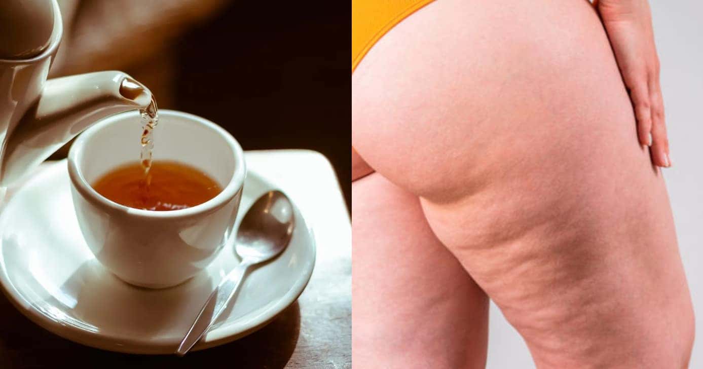 Com esse chá poderoso, você vai conseguir se livrar da celulite (Foto: Montagem)