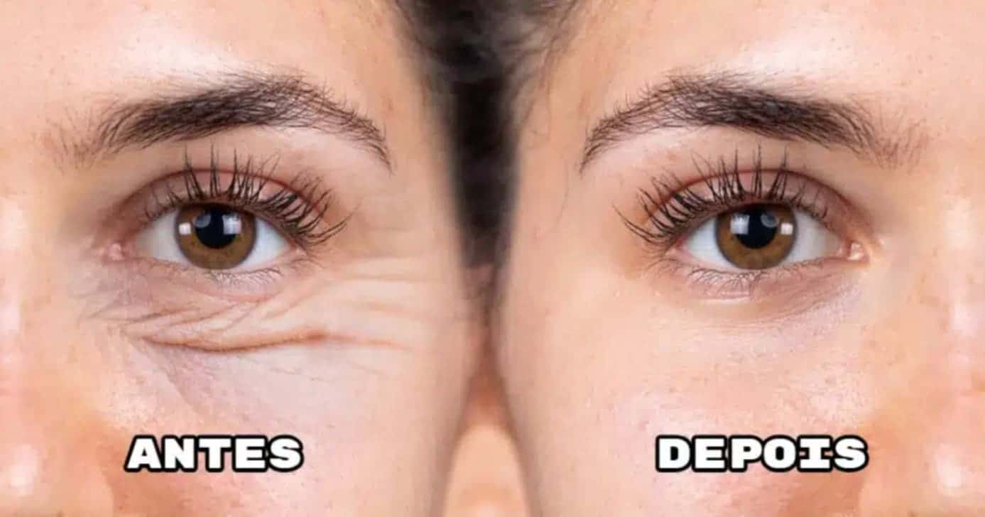 Máscara natural com 3 ingredientes hidrata a pele e reduz rugas na primeira aplicação - Foto: Internet