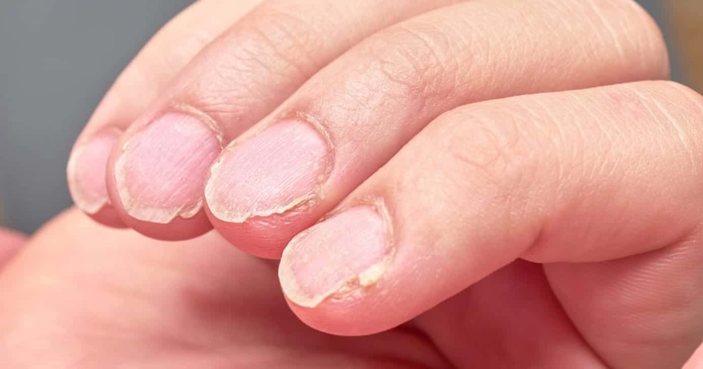 Suas unhas podem ser destruídas por essa ações (Foto: Divulgação)