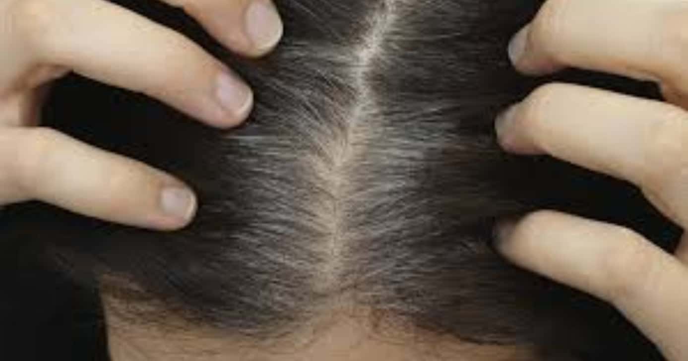Saiba o que fazer para cobrir seus cabelos brancos em casa (Foto: Divulgação)