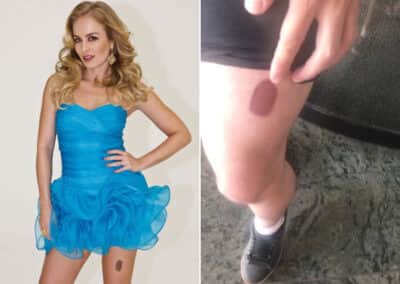 Imagem card com fundo