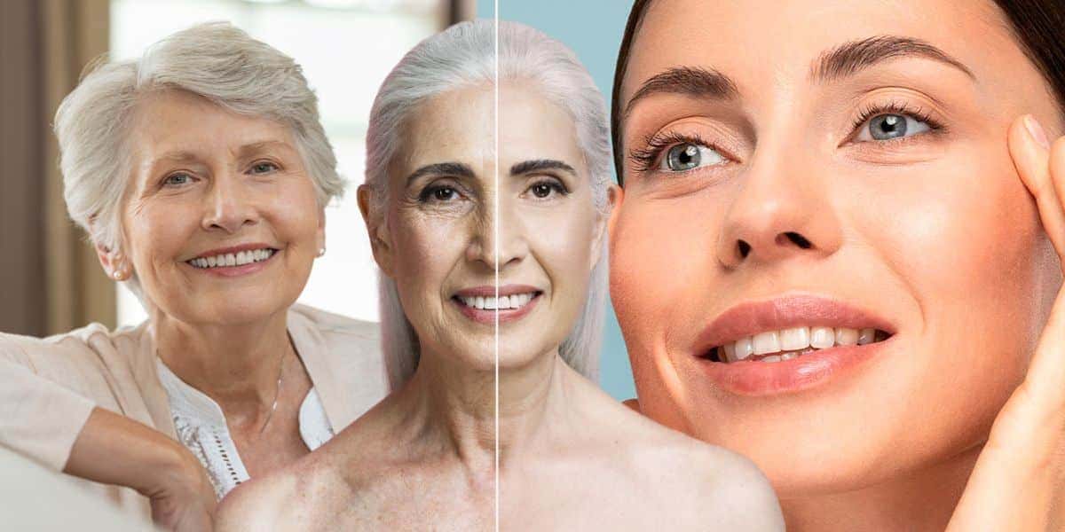 Mulheres antes e depois - Foto Reprodução Internet