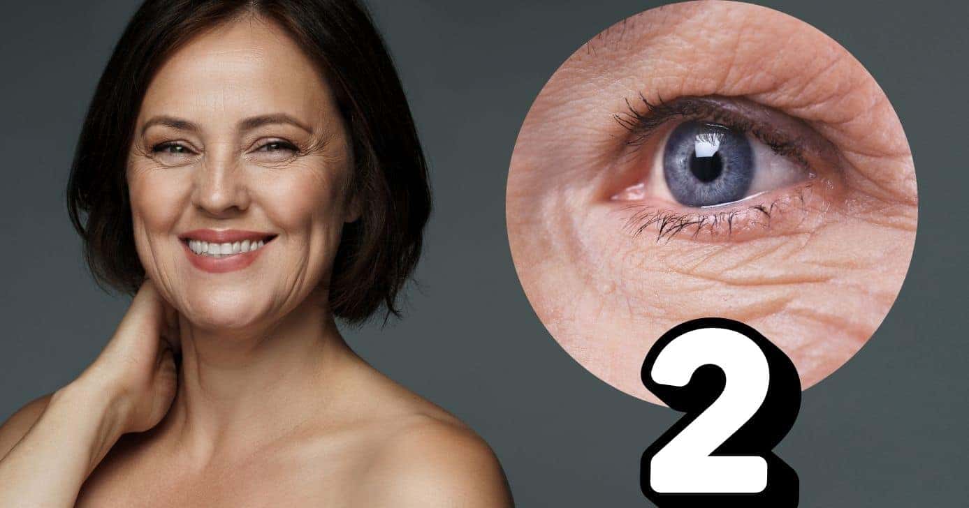 Mulher com e sem rugas (Foto: Reprodução / Canva / Montagem TV Foco)