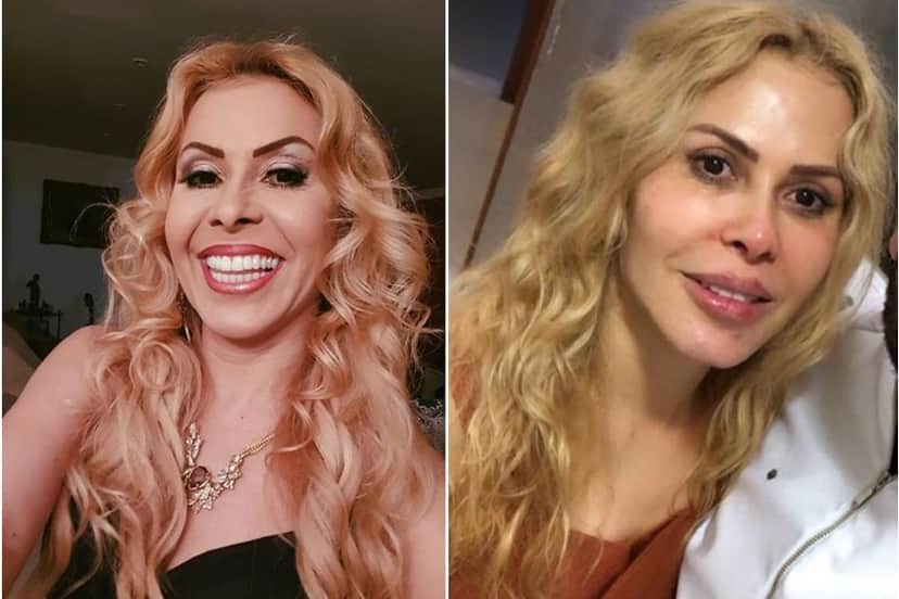 Joelma passou por procedimento de harmonização facial recentemente Joelma passou por procedimento de harmonização facial recentemente