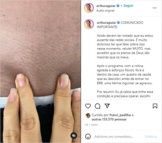 Arthur Aguiar confirma sério diagnóstico e cirurgia - Foto: Reprodução Arthur Aguiar confirma sério diagnóstico e cirurgia - Foto: Reprodução