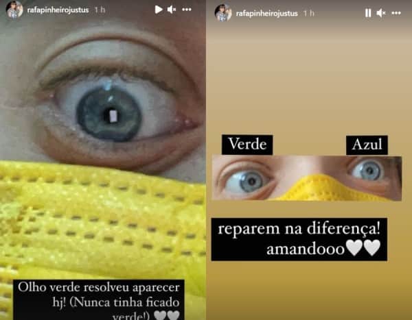 Rafinha Justus mostra mudança na coloração dos olhos por conta da luz (Foto: Reprodução) Rafinha Justus mostra mudança na coloração dos olhos por conta da luz (Foto: Reprodução)