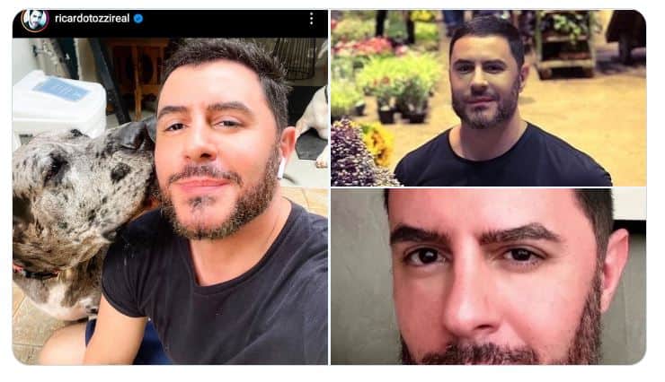 O famoso Ricardo Tozzi, da Globo, passa por procedimento no rosto e antes e depois choca a web - Foto Reprodução O famoso Ricardo Tozzi, da Globo, passa por procedimento no rosto e antes e depois choca a web - Foto Reprodução