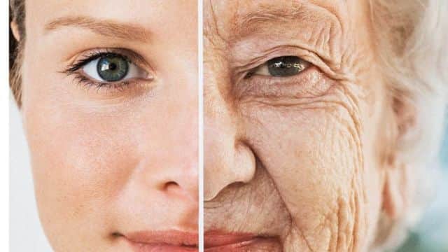 Algumas dicas para fugir das rugas e do botox (Foto: Reprodução/ Internet) Algumas dicas para fugir das rugas e do botox (Foto: Reprodução/ Internet)