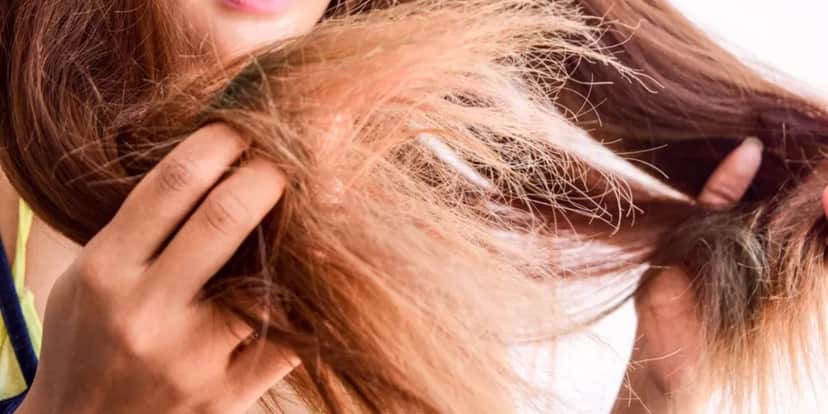 Evite ficar com o cabelo ressecado e com pontas duplas (Reprodução: Internet) Evite ficar com o cabelo ressecado e com pontas duplas (Reprodução: Internet)