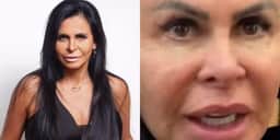 Gretchen surge careca e faz confissão chocante: “Perdi todo o cabelo”