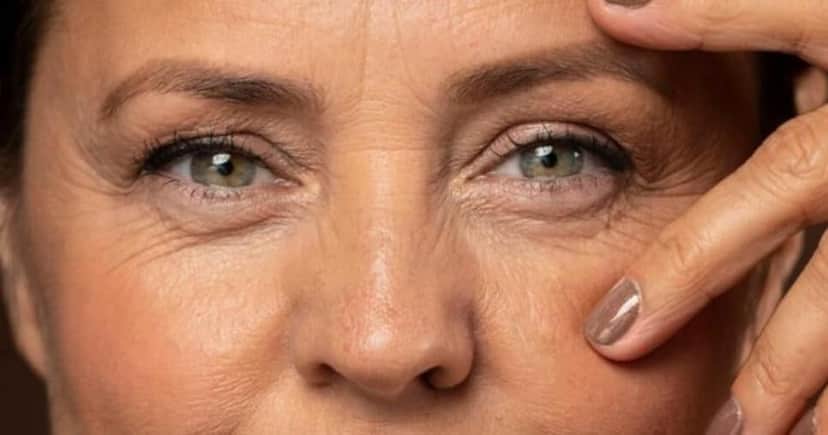 Graças a essa receita natural, você conseguirá se livrar das rugas (Foto: Montagem) Graças a essa receita natural, você conseguirá se livrar das rugas (Foto: Montagem)