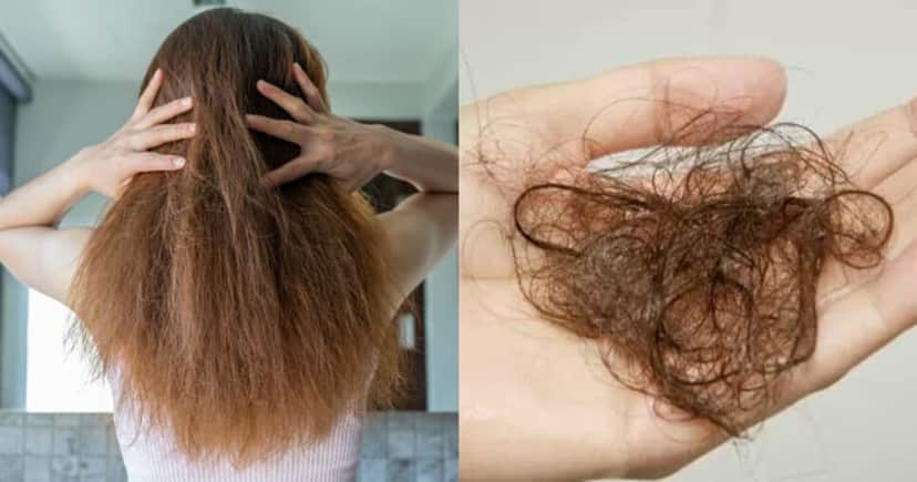 Queda de cabelo ao usar canetas para emagrecer: Especialista ensina como diminuir http://tvfoco.uai.com.br/wp-content/uploads/2015/05/Daniela-Mercury.jpg
