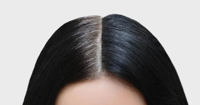 Cabelo branco antes e depois - Foto: Internet Cabelo branco antes e depois - Foto: Internet