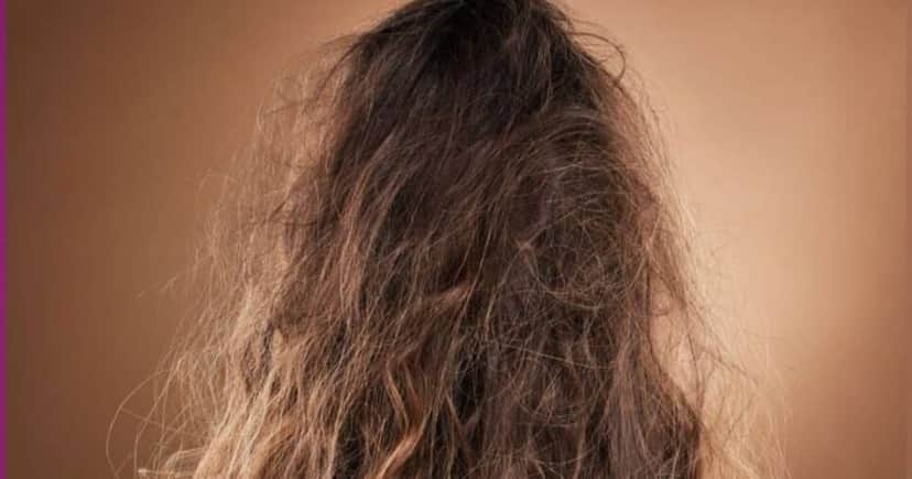 Cabelo com frizz - Foto: Internet Cabelo com frizz - Foto: Internet
