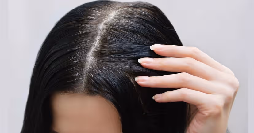 Óleo natural cobre o cabelo branco (Foto: Reprodução/ Internet) Óleo natural cobre o cabelo branco (Foto: Reprodução/ Internet)