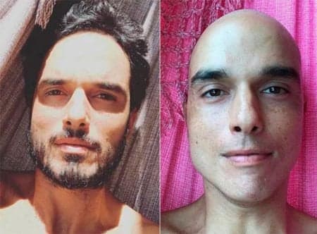 Léo Rosa celebra cura da doença: "Fim do assunto"