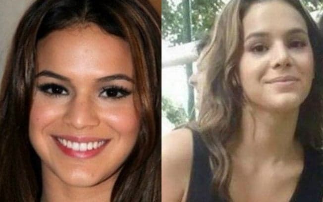 Bruna Marquezine decide falar a verdade pela primeira vez sobre cirurgia polêmica no nariz