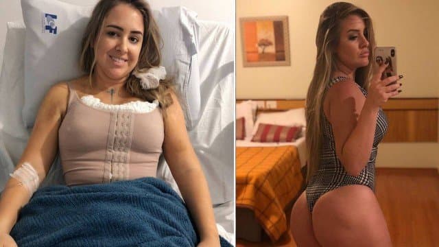 Patrícia, do BBB18, fez lipoescutura, colocou silicone nos seios e injetou gordura no bumbum (Foto: Reprodução/Instagram) Patrícia, do BBB18, fez lipoescutura, colocou silicone nos seios e injetou gordura no bumbum (Foto: Reprodução/Instagram)
