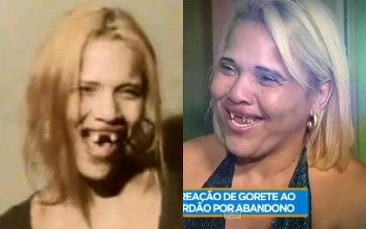 Gorete que virou Gisele perde os dentes novamente e é socorrida pela Record