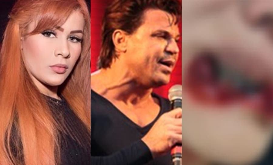 Polícia exige a prisão da ex de Eduardo Costa que arrancou os lábios de mulher com a boca