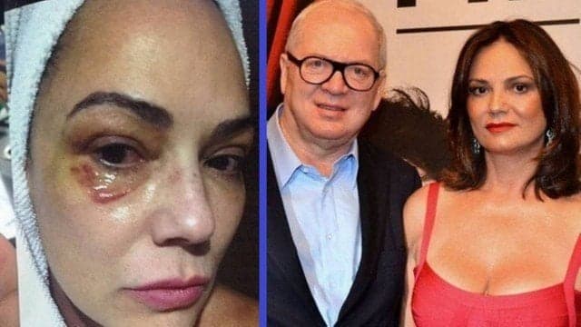 Após ter sido espancada, Luiza Brunet vence Lírio Parisotto na justiça e condenação é definida