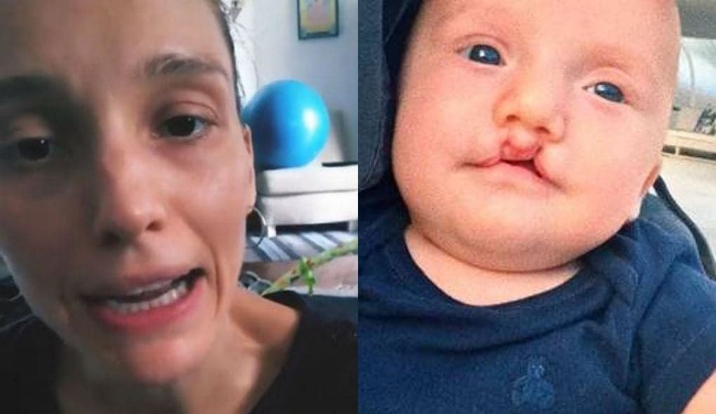 Sobrinho de Ana Hickmann vai passar por cirurgia e irmã da apresentadora se desespera