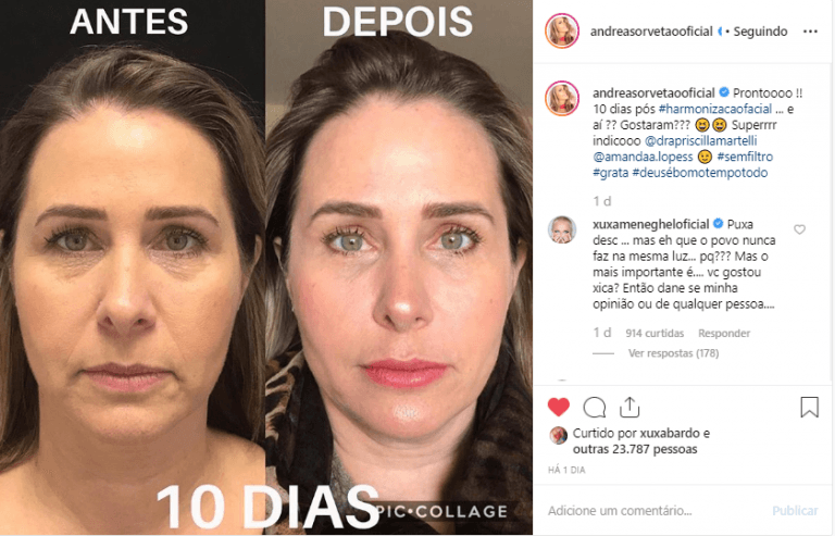 Xuxa faz novo comentário sobre visual de Andréa Sorvetão (Foto: Reprodução) Xuxa faz novo comentário sobre visual de Andréa Sorvetão (Foto: Reprodução)