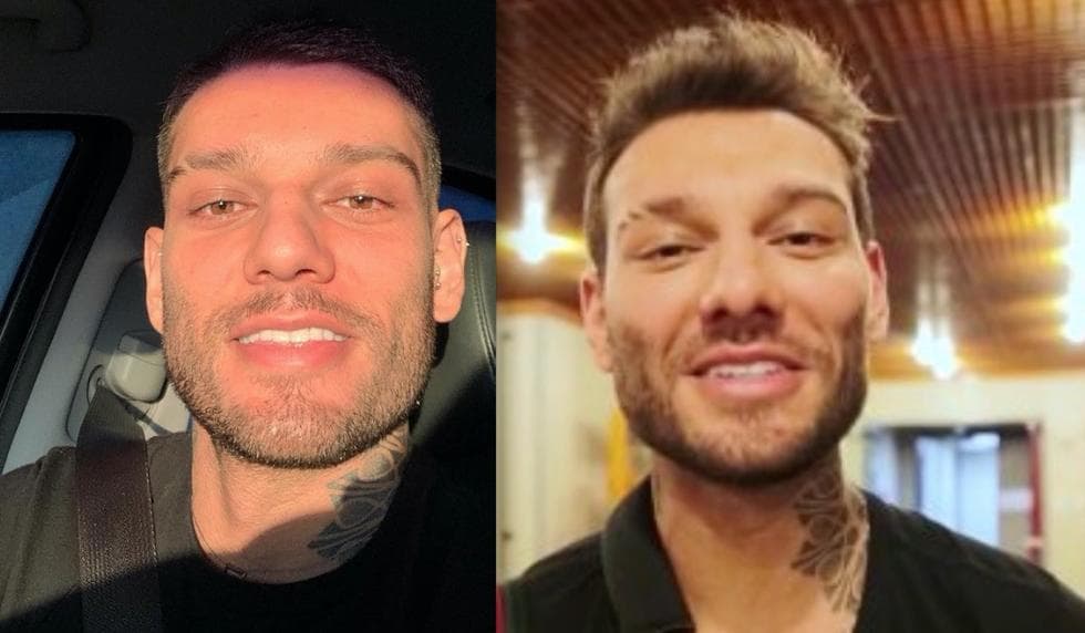 Lucas Lucco, após surgir com rosto desconfigurado, revela tudo e deixa fãs desesperados com problema de saúde