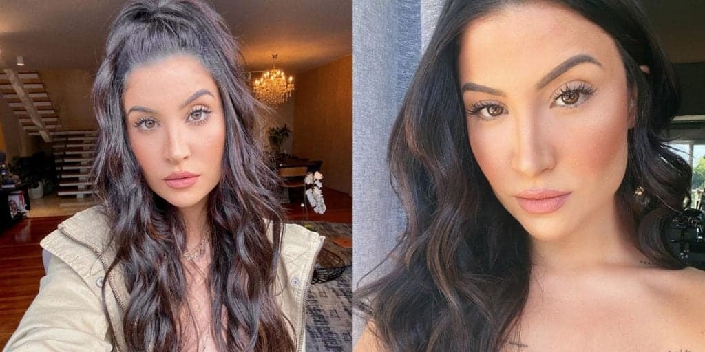 Bianca Andrade impressiona ao mostrar antes e depois após se submeter a procedimento estético: "Gostei muito”