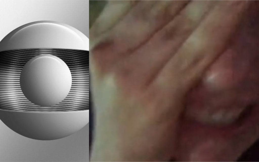 Atriz da Globo, após diagnóstico de doença, vai parar às pressas em sala de cirurgia e trágico acidente vem à tona