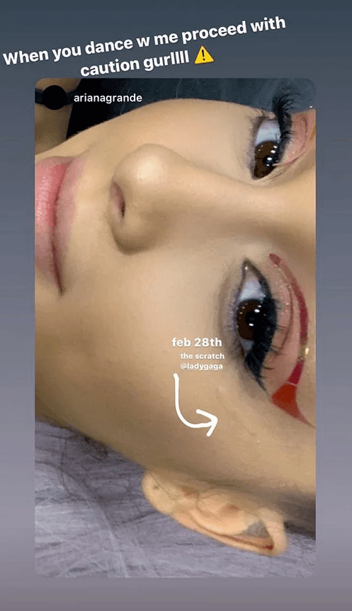 Stories feito por Ariana Grande mostrando o arranhão (Foto: Reprodução)