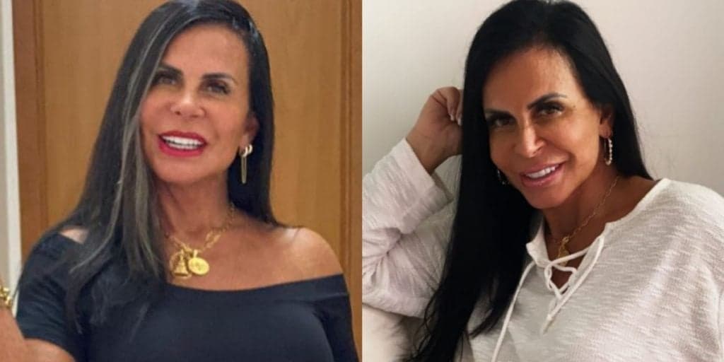 Gretchen se prepara para 18° casamento com nova harmonização facial e mostra resultado: "Perfeito"