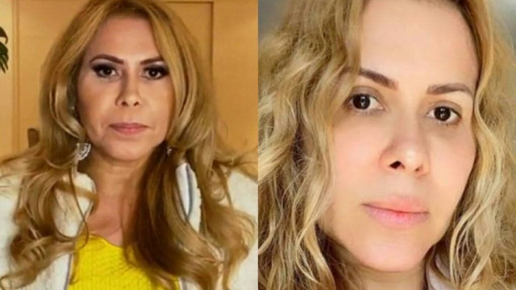 Joelma sofre com sequelas após grave doença: "Afetou minha visão e minha mente"
