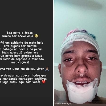 MC Brinquedo se manifestou nas redes sociais após acidente (Foto: Montagem) MC Brinquedo se manifestou nas redes sociais após acidente (Foto: Montagem)