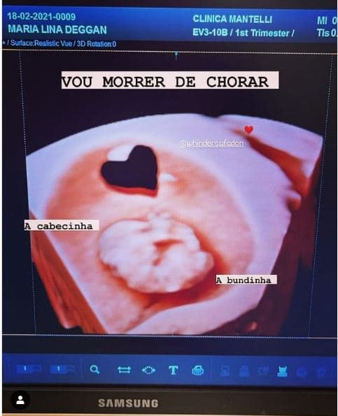 Foto do filho de Whind (Foto: Reprodução)