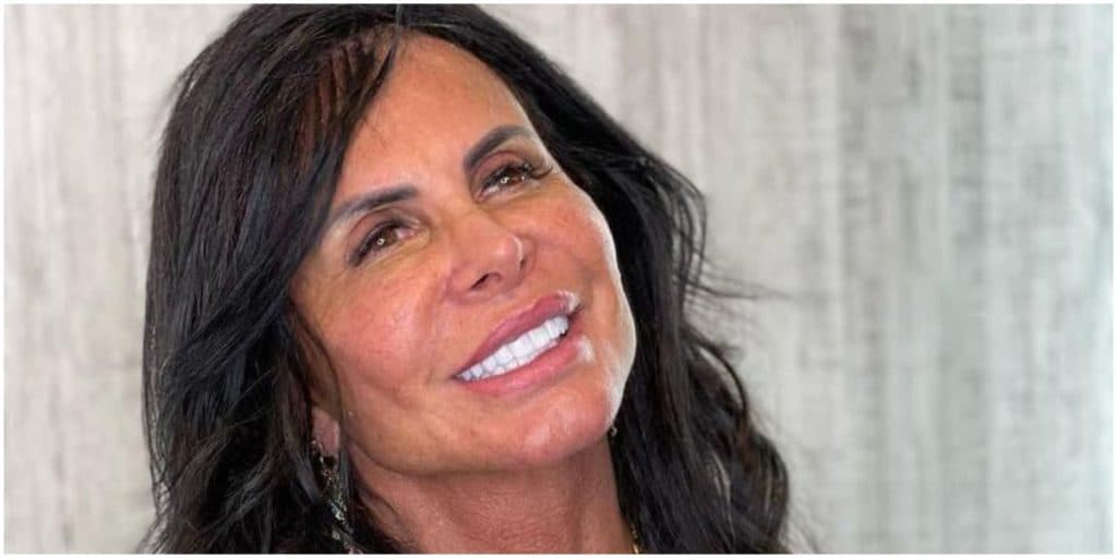 Gretchen choca, faz procedimento facial, mostra resultado e público fica incrédulo com resultado: "É você?"