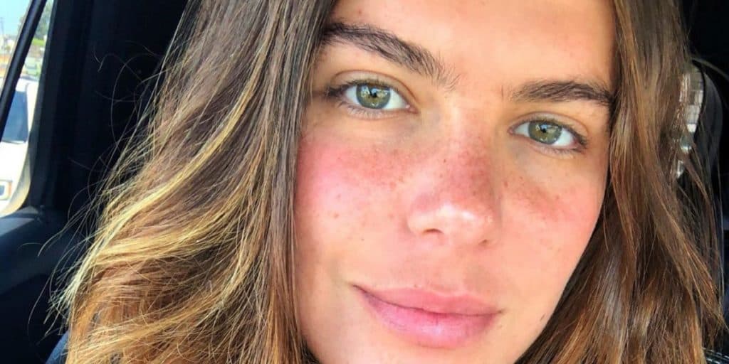 Mariana Goldfarb, após lutar contra grave doença, explode com pressão sobre o seu corpo: "difícil acreditar"