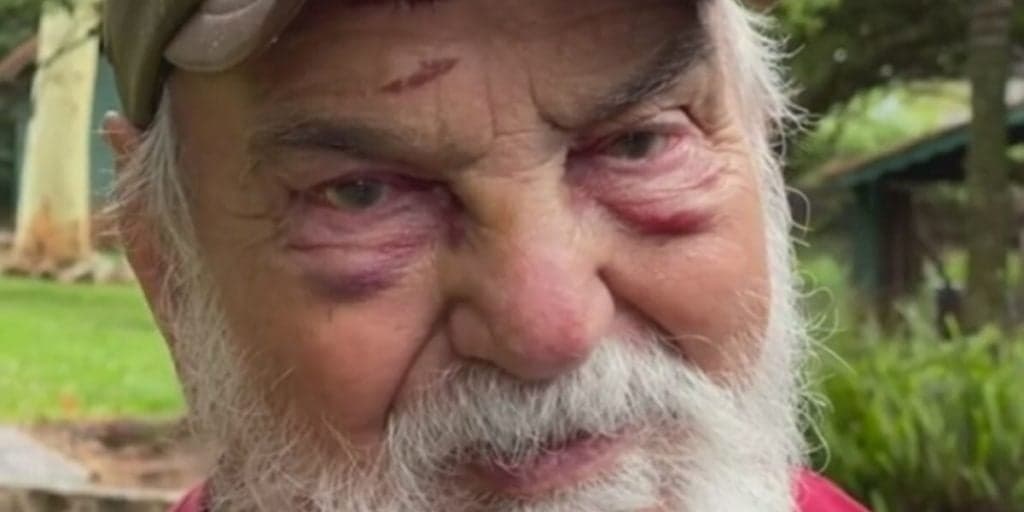 “É definitivo”, Globo dá notícia envolvendo Lima Duarte, aos 91 anos, após acidente inesperado e rosto desfigurado