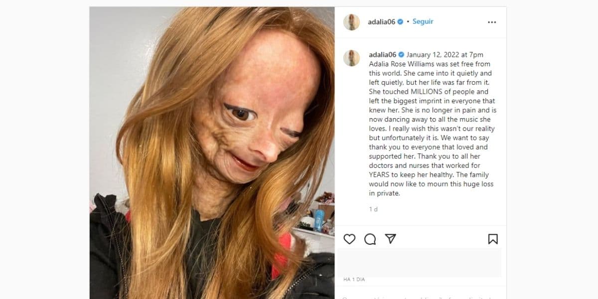 LUTO! Morre grande estrela aos 15 anos por doença incurável e anúncio devasta: "Está livre deste mundo" LUTO! Morre grande estrela aos 15 anos por doença incurável e anúncio devasta: "Está livre deste mundo"