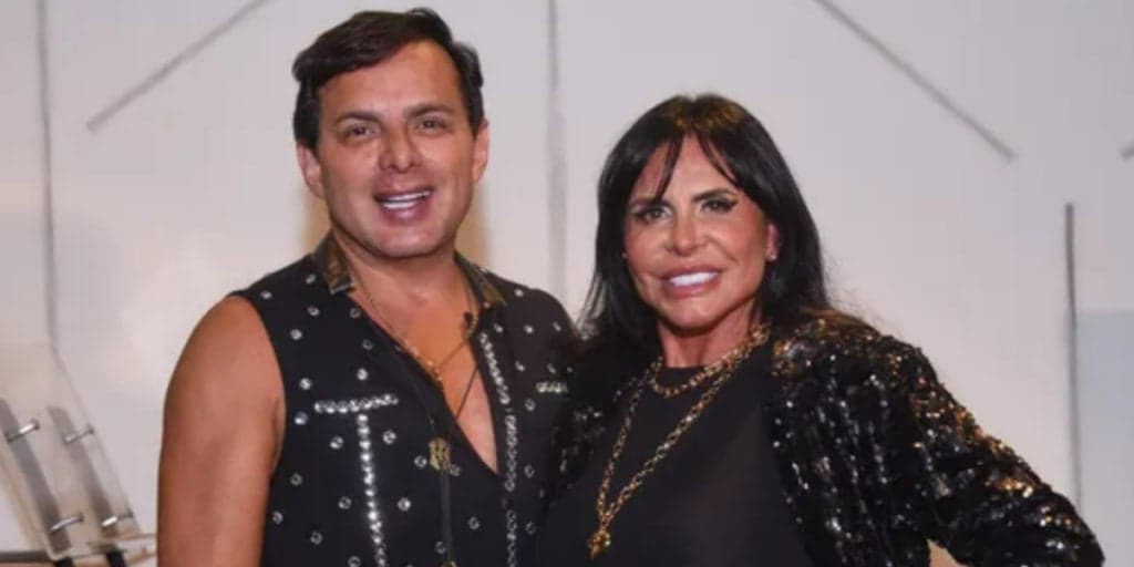 Esdras de Souza, marido de Gretchen, surge careca, mostra procedimentos estéticos e choca com resultado