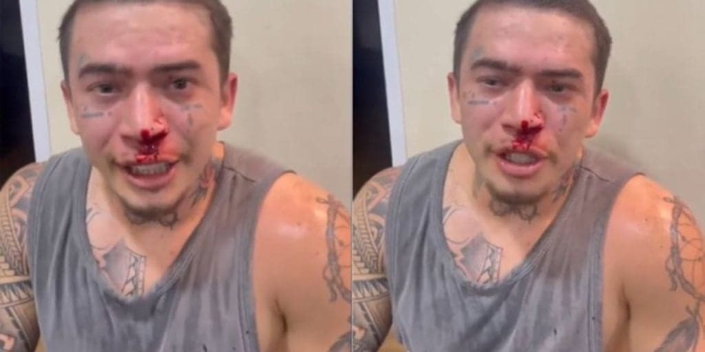 Whindersson Nunes aparece com rosto coberto de sangue e choca os fãs: "Mexi com o cara errado"
