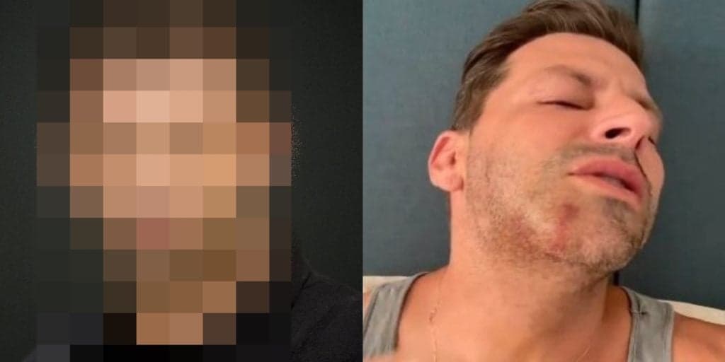 Como está o ator Henri Castelli hoje, após ficar com o rosto deformado e ser brutalmente espancado
