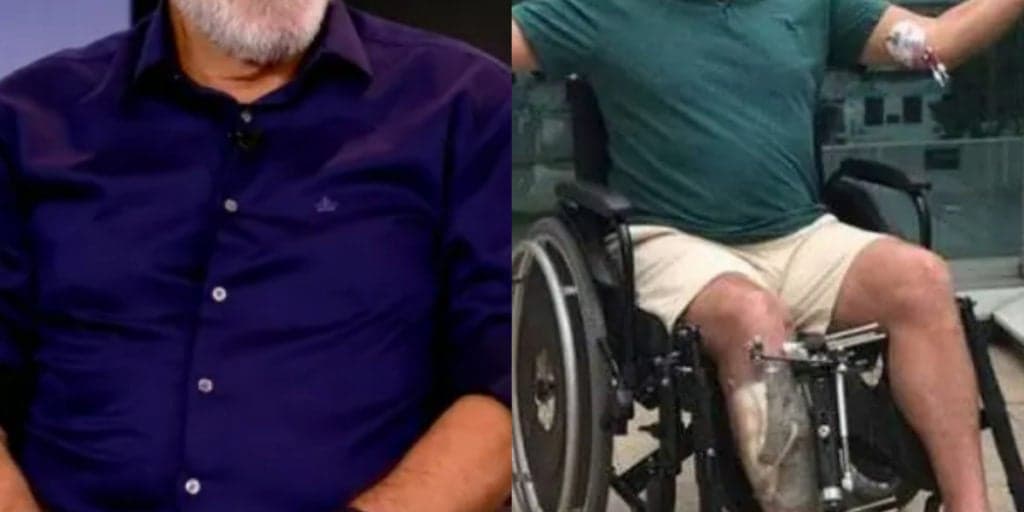 Galã da Globo teve perna necrosada após acidente e quase morreu após 65 cirurgias: "No osso"