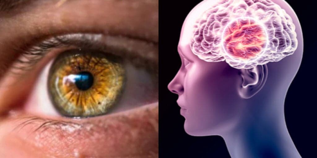 Atenção: Primeiros sinais de Alzheimer surgem nos olhos, dizem cientistas e se você tem é bom tomar cuidado